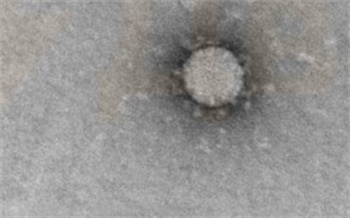 Новосибирские ученые показали коронавирус под микроскопом
