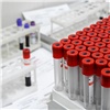 Администрация Железногорска сообщила о рекордном количестве заболевших коронавирусом за сутки