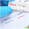 В красноярском Центре СПИД начали делать экспресс-тесты на коронавирус: результат обещают за 2 часа
