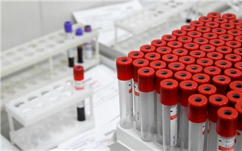 «Проблема распространения ВИЧ остается актуальной»: красноярцев бесплатно проверят на инфекцию