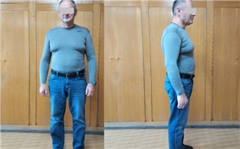 Красноярец похудел на 40 кг после уменьшения желудка и рассказал о самочувствии
