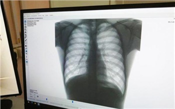 Дети и подростки в Красноярском крае стали меньше болеть туберкулезом