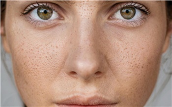 Дерматолог предупредила об опасности отопительного сезона для кожи