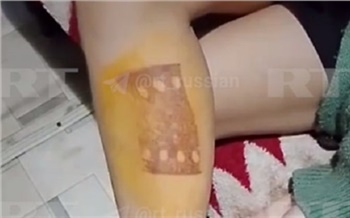 В Приангарье школьники прижгли девочке ноги утюгом после ссоры