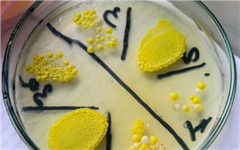 Ученые из Красноярска рассказали, чем пахнут опасные бактерии