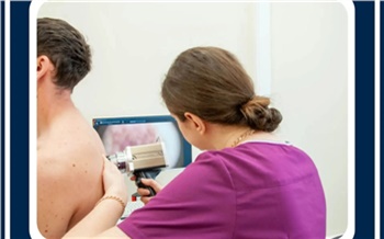 Краевой онкодиспансер предлагает красноярцам проверить родинки