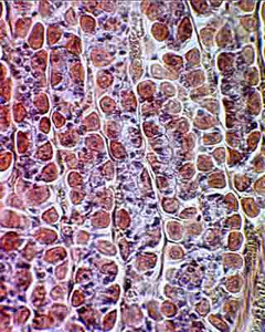 Слизистая желудка