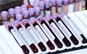 СПИД наступает