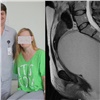 Красноярские врачи удалили женщине гигантскую кисту с регбийный мяч