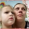 В Ачинске 4-летнюю девочку едва не разодрала стая бродячих собак (видео)