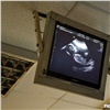 Красноярский край вошел в топ регионов по количеству абортов