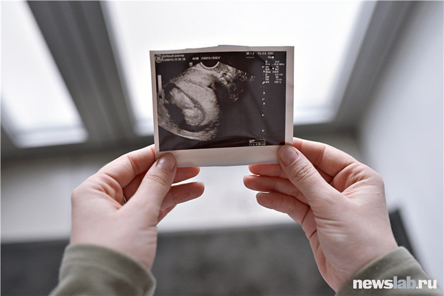 Осложнения переношенной беременности и их профилактика