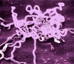 Сифилис под микроскопом